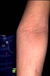 Kubuto-10 semajno poste