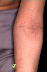 Kubuto-15 semajno poste