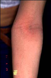 Kubuto-1 semajno poste