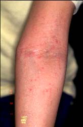 Kubuto-6 semajno poste