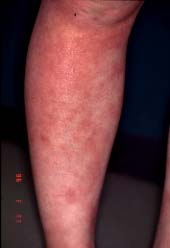 antau~a malsupra kururo-unue