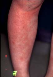 antau~a malsupra kururo-1 monato