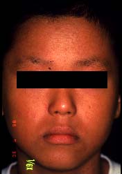 ���-�P�N��