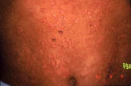 abdomeno-2 semajnoj
