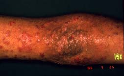 �I��-���f��