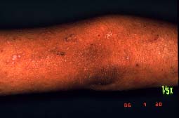 �I��-�P�N��