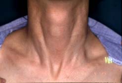 neck-first coming