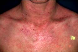 ���� ���f��