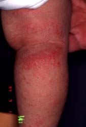 malsupra membro unue