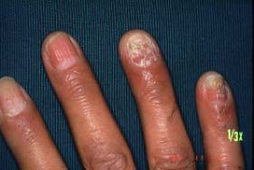nail-at first coming